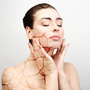 Recomendaciones para cuidar la piel seca