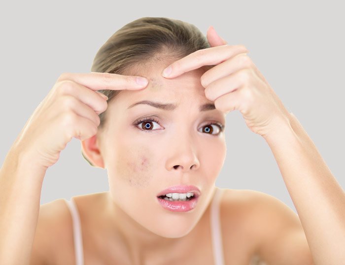como eliminar las manchas de la cara