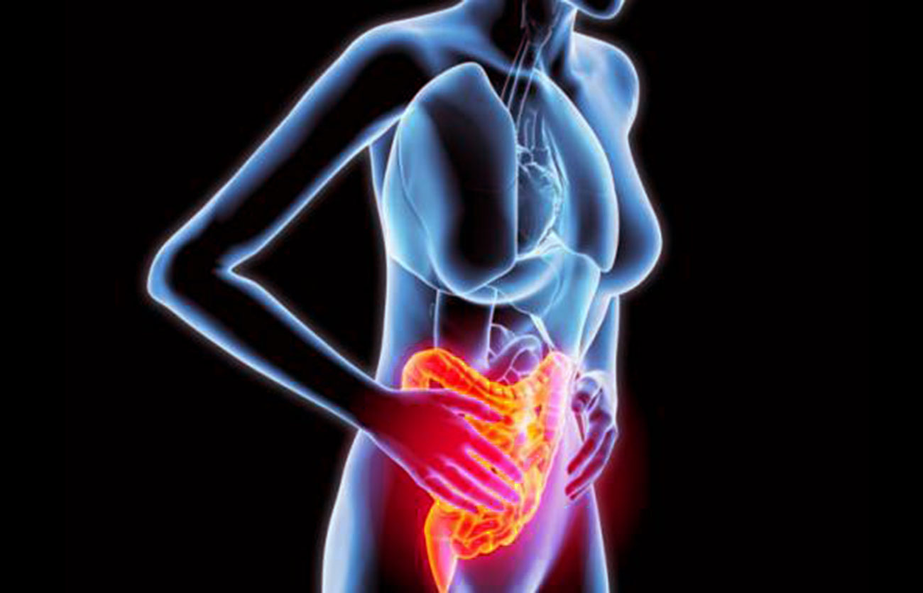 cuidados de la colitis
