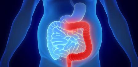colitis ulcerosa cuídate