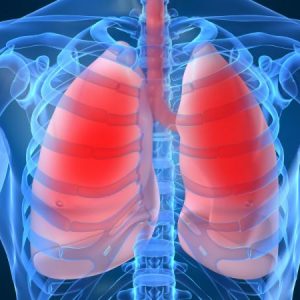 síntomas de la pulmnía doble